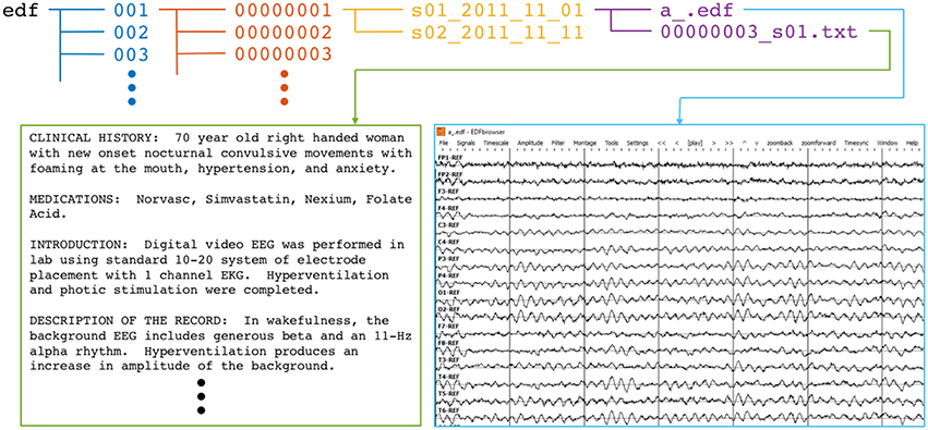 tuh_dataset